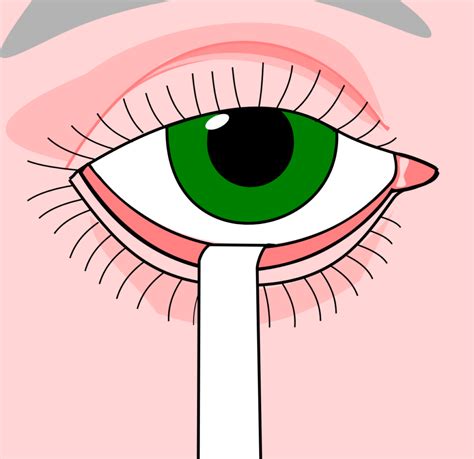 tear break up time test|schirmer test for dry eye.